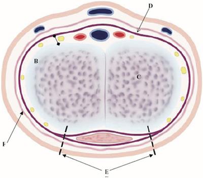 Treatment of the Enlarged Clitoris